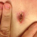 Belly button isn't looking good.