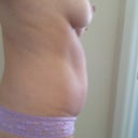 pre-op