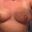 2 weeks post