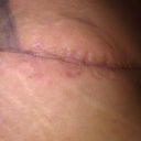 18 days after