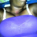 The new boobies :)!!! They're swollen but smaller I'm now 2 days Post-Op.