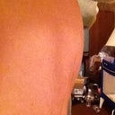 Random swelling in upper abdomen!