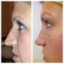 before surgery / 2 weeks after surgery