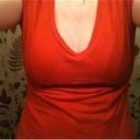 This is about 7 months post op, taken December 4, 2010. I am so happy compared to before...