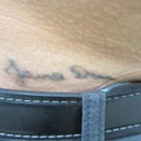 Before starting 2nd treatment