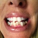 original teeth