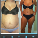 Before and After