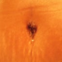 BB--still have stretch marks :(
