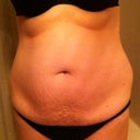 44 days before surgery. I really want to get 8 lbs off before surgery..