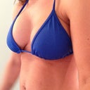 6 wk post op