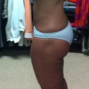 This was taken on April 20. Almost 3 months post-op.