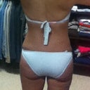 This was taken on April 20. Almost 3 months post-op.