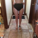 15 days post