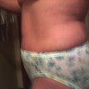 3 day post op
