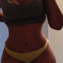 4 months post op