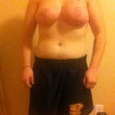 eight weeks post op