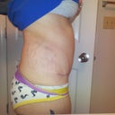 3.5wks PO