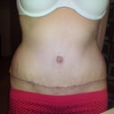 4wks PO