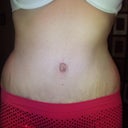 4wks PO