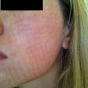 3 days after
