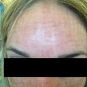 5 days after