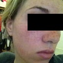 5 days after