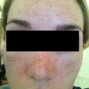 5 days after