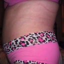 4 weeks PO Pic
