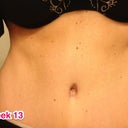 BB healing nicely & I little ab definition that was under all that flabby flab hot mess!