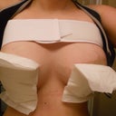 a few hours after surgery