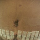 my new tummy