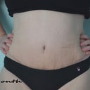 Got my PMS here and I am quite swollen and in pain from swelling.