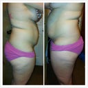 Before right and left side view