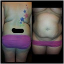 Back and Front view before
