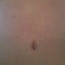 belly button 4 months