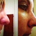 Day seven. See the difference in the tip