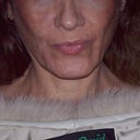Before photo, showing "problem area"