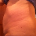 Before Side View