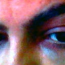 AFTER TREATMENT eyes
