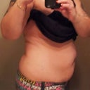 Side view, week before procedure