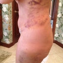 swollen today