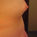 Side view before. I've never like the 'cone' like shape