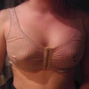 Day of surgery.  Blood is from mole removal sure hopes it comes out I want to keep this sexy number lol