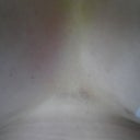 Bruise on sternum swelling starting to go down