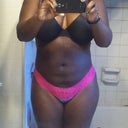 27 days post op front