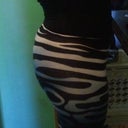 27 days post op with compression garment