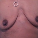 Before Front View