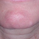 Neck before.