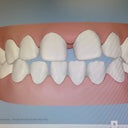 Teeth before