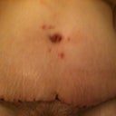 At the gym, wearing a CG to help swelling. 3 Weeks PO.